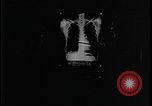 Standbild Native American Indian Jugend Tuberkulose United States USA, 1941, aus Sekunde 50 historischem Filmmaterial Videoclip 65675078234
