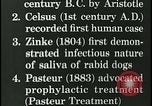 Immagine di Rabbia nel cervello umano United States USA, 1927, secondo 11 filmato di repertorio 65675078239