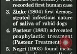 Immagine di Rabbia nel cervello umano United States USA, 1927, secondo 15 filmato di repertorio 65675078239