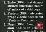 Immagine di Rabbia nel cervello umano United States USA, 1927, secondo 18 filmato di repertorio 65675078239