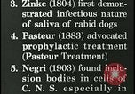 Immagine di Rabbia nel cervello umano United States USA, 1927, secondo 19 filmato di repertorio 65675078239