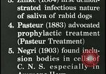 Immagine di Rabbia nel cervello umano United States USA, 1927, secondo 20 filmato di repertorio 65675078239