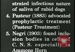 Immagine di Rabbia nel cervello umano United States USA, 1927, secondo 21 filmato di repertorio 65675078239