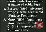 Immagine di Rabbia nel cervello umano United States USA, 1927, secondo 22 filmato di repertorio 65675078239