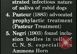 Immagine di Rabbia nel cervello umano United States USA, 1927, secondo 23 filmato di repertorio 65675078239