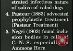Immagine di Rabbia nel cervello umano United States USA, 1927, secondo 25 filmato di repertorio 65675078239