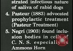 Immagine di Rabbia nel cervello umano United States USA, 1927, secondo 27 filmato di repertorio 65675078239