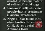 Immagine di Rabbia nel cervello umano United States USA, 1927, secondo 29 filmato di repertorio 65675078239