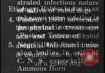 Immagine di Rabbia nel cervello umano United States USA, 1927, secondo 31 filmato di repertorio 65675078239
