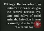 Immagine di Rabbia nel cervello umano United States USA, 1927, secondo 37 filmato di repertorio 65675078239