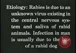 Immagine di Rabbia nel cervello umano United States USA, 1927, secondo 42 filmato di repertorio 65675078239