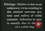 Immagine di Rabbia nel cervello umano United States USA, 1927, secondo 45 filmato di repertorio 65675078239