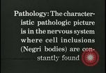 Immagine di Rabbia nel cervello umano United States USA, 1927, secondo 59 filmato di repertorio 65675078239