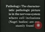 Immagine di Rabbia nel cervello umano United States USA, 1927, secondo 62 filmato di repertorio 65675078239