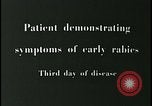 Image of Patient with early stage rabies Iran, 1955, second 1 stock footage video 65675078245