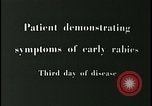 Image of Patient with early stage rabies Iran, 1955, second 3 stock footage video 65675078245
