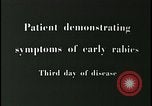 Image of Patient with early stage rabies Iran, 1955, second 4 stock footage video 65675078245
