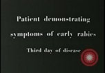 Image of Patient with early stage rabies Iran, 1955, second 7 stock footage video 65675078245