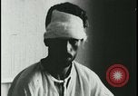 Image of Patient with early stage rabies Iran, 1955, second 22 stock footage video 65675078245