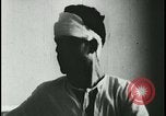 Image of Patient with early stage rabies Iran, 1955, second 39 stock footage video 65675078245