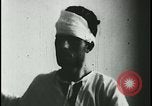 Image of Patient with early stage rabies Iran, 1955, second 40 stock footage video 65675078245
