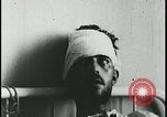Image of Patient with early stage rabies Iran, 1955, second 53 stock footage video 65675078245