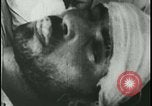 Image of Iranian Villager dying after being bitten by rabid wolf Iran, 1955, second 35 stock footage video 65675078246