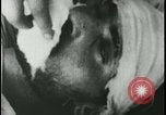 Image of Iranian Villager dying after being bitten by rabid wolf Iran, 1955, second 39 stock footage video 65675078246