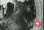 Image of Iranian Villager dying after being bitten by rabid wolf Iran, 1955, second 56 stock footage video 65675078246