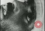 Image of Iranian Villager dying after being bitten by rabid wolf Iran, 1955, second 59 stock footage video 65675078246