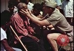 Image of fallout victims examined Bikini Atoll Marshall Islands, 1954, second 5 stock footage video 65675078698