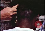 Image of fallout victims examined Bikini Atoll Marshall Islands, 1954, second 26 stock footage video 65675078698