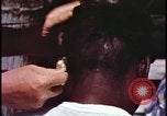 Image of fallout victims examined Bikini Atoll Marshall Islands, 1954, second 27 stock footage video 65675078698