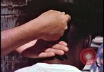 Image of fallout victims examined Bikini Atoll Marshall Islands, 1954, second 32 stock footage video 65675078698