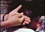 Image of fallout victims examined Bikini Atoll Marshall Islands, 1954, second 33 stock footage video 65675078698