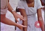 Image of fallout victims examined Bikini Atoll Marshall Islands, 1954, second 48 stock footage video 65675078698