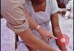 Image of fallout victims examined Bikini Atoll Marshall Islands, 1954, second 50 stock footage video 65675078698