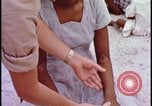 Image of fallout victims examined Bikini Atoll Marshall Islands, 1954, second 51 stock footage video 65675078698