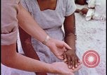 Image of fallout victims examined Bikini Atoll Marshall Islands, 1954, second 52 stock footage video 65675078698