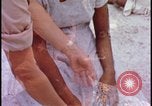 Image of fallout victims examined Bikini Atoll Marshall Islands, 1954, second 53 stock footage video 65675078698