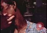 Image of fallout victims examined Bikini Atoll Marshall Islands, 1954, second 54 stock footage video 65675078698