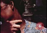 Image of fallout victims examined Bikini Atoll Marshall Islands, 1954, second 55 stock footage video 65675078698