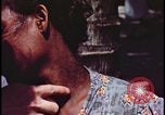 Image of fallout victims examined Bikini Atoll Marshall Islands, 1954, second 56 stock footage video 65675078698
