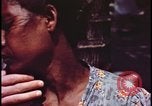 Image of fallout victims examined Bikini Atoll Marshall Islands, 1954, second 58 stock footage video 65675078698