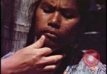 Image of fallout victims examined Bikini Atoll Marshall Islands, 1954, second 59 stock footage video 65675078698