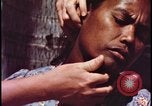 Image of fallout victims examined Bikini Atoll Marshall Islands, 1954, second 60 stock footage video 65675078698