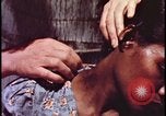 Image of fallout victims examined Bikini Atoll Marshall Islands, 1954, second 62 stock footage video 65675078698
