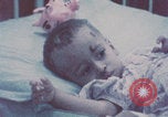 Image of wounded Iranians Iran, 1980, second 11 stock footage video 65675078926