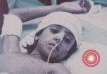 Image of wounded Iranians Iran, 1980, second 13 stock footage video 65675078926