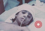 Image of wounded Iranians Iran, 1980, second 14 stock footage video 65675078926